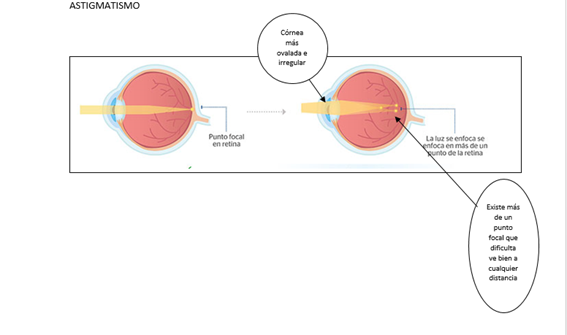 OJO7