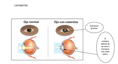 OJO8