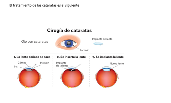 OJO9