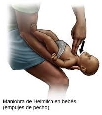 Imagen10